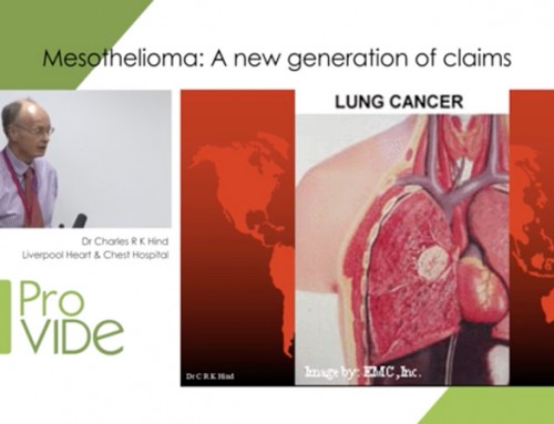 Mesothelioma: a new generation of claims